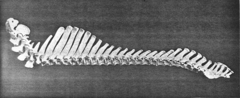 Vertebrae