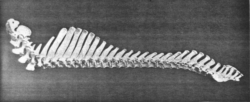 Vertebrae